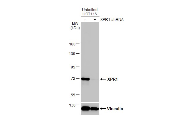 Non-transfected (-) and transfected (+) unboiled HCT-116 whole cell extract (30 ug) were separated by 7.5% SDS-PAGE, and the membrane was blotted with XPR1 antibody [HL2631] (NBP3-48708) diluted at 1:1000. The HRP-conjugated anti-rabbit IgG antibody was used to detect the primary antibody. 