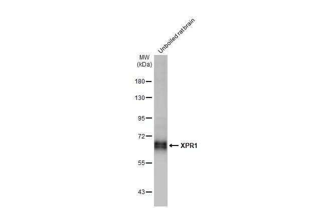 Western Blot XPR1 Antibody (HL2632)