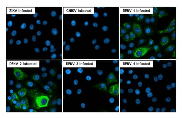 Dengue Virus NS3 antibody [HL2634] detects Dengue Virus NS3 protein by immunofluorescent analysis.Sample: Mock and infected Multiple virus infected cells slide cells were fixed in Multiple virus kit.Green: Dengue Virus NS3 stained by Dengue Virus NS3 antibody [HL2634] (NBP3-48710) diluted at 1:100.Blue: Fluoroshield with DAPI . 