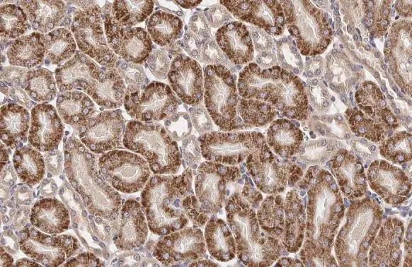 Immunohistochemistry-Paraffin GnRHR Antibody (HL2638)
