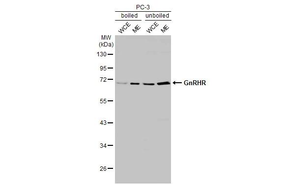 Western Blot GnRHR Antibody (HL2638)