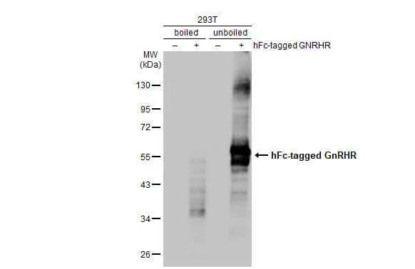 Non-transfected (-) and transfected (+) boiled and unboiled 293T whole cell extracts (30 ug) were separated by 10% SDS-PAGE, and the membrane was blotted with GnRHR antibody [HL2638] (NBP3-48712) diluted at 1:5000. The HRP-conjugated anti-rabbit IgG antibody was used to detect the primary antibody. 
