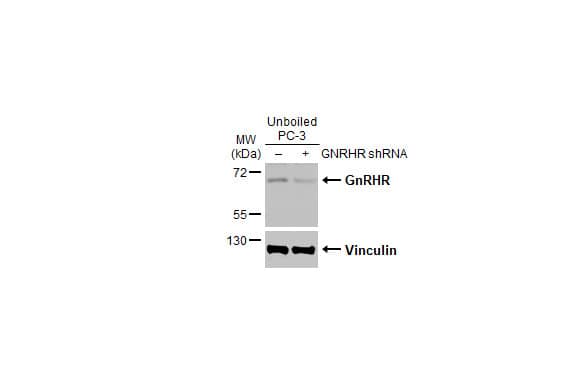 Non-transfected (-) and transfected (+) unboiled PC-3 whole cell extracts (30 ug) were separated by 10% SDS-PAGE, and the membrane was blotted with GnRHR antibody [HL2638] (NBP3-48712) diluted at 1:1000. The HRP-conjugated anti-rabbit IgG antibody was used to detect the primary antibody. 