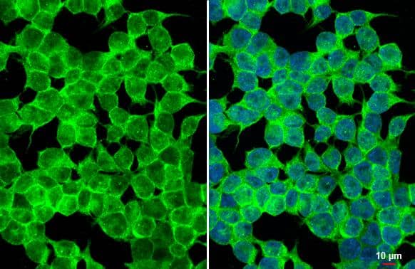 HAP40 antibody [HL2641] detects HAP40 protein at cytoplasm by immunofluorescent analysis.Sample: 293T cells were fixed in ice-cold MeOH for 5 min.Green: HAP40 stained by HAP40 antibody [HL2641] (NBP3-48713) diluted at 1:500.Blue: Fluoroshield with DAPI . 