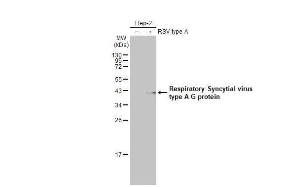 Western Blot Respiratory Syncytial Virus Subgroup A G Glycoprotein Antibody (HL2643)