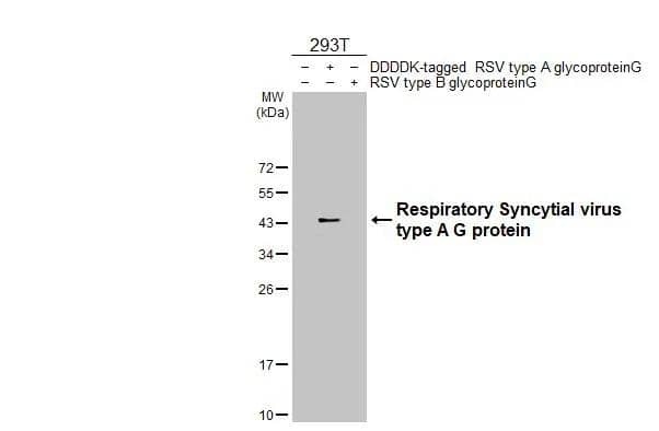 Western Blot Respiratory Syncytial Virus Subgroup A G Glycoprotein Antibody (HL2643)