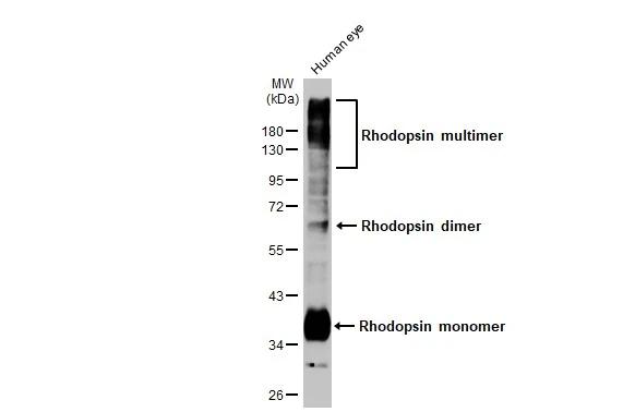 Human tissue extract was separated by 10% SDS-PAGE, and the membrane was blotted with Rhodopsin antibody [HL2668] (NBP3-48717) diluted at 1:1000. The HRP-conjugated anti-rabbit IgG antibody was used to detect the primary antibody. 