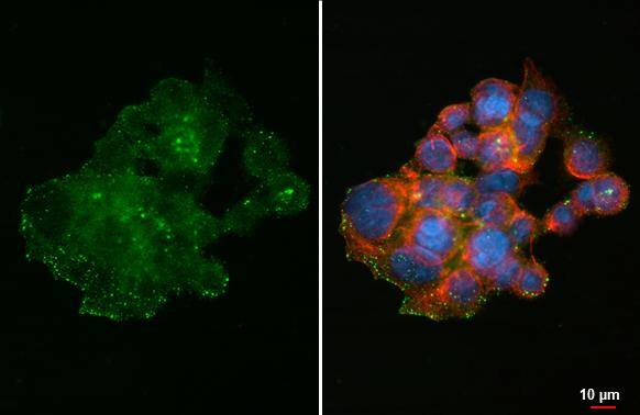 <b>Orthogonal Strategies Validation. </b>FAM20C antibody [HL2677] detects FAM20C protein at cytoplasmic vesicles by immunofluorescent analysis.Sample: HepG2 cells were fixed in ice-cold MeOH for 5 min.Green: FAM20C stained by FAM20C antibody [HL2677] (NBP3-48718) diluted at 1:500.Red: alpha Tubulin, a cytoskeleton marker, stained by alpha Tubulin antibody [GT114] diluted at 1:1000.Blue: Fluoroshield with DAPI . 