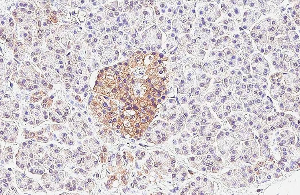 P2Y1/P2RY1 antibody [HL2702] detects P2Y1/P2RY1 protein by immunohistochemical analysis.Sample: Paraffin-embedded human pancreas.P2Y1/P2RY1 stained by P2Y1/P2RY1 antibody [HL2702] (NBP3-48720) diluted at 1:100.Antigen Retrieval: Citrate buffer, pH 6.0, 15 min 