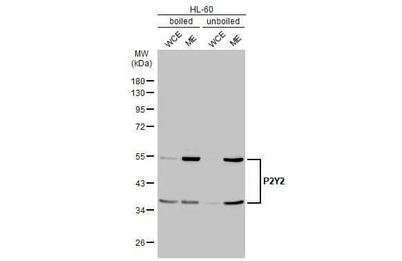 Western Blot P2Y2 Antibody (HL2704)