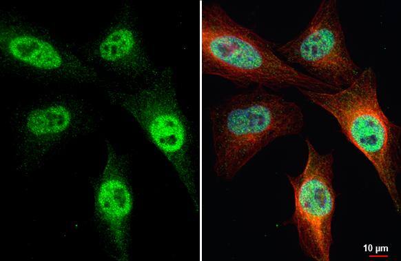 SETD1A antibody [HL2705] detects SETD1A protein at cytoplasm and nucleus by immunofluorescent analysis.Sample: HeLa cells were fixed in 4% paraformaldehyde at RT for 15 min.Green: SETD1A stained by SETD1A antibody [HL2705] (NBP3-48722) diluted at 1:500.Red: alpha Tubulin, a cytoskeleton marker, stained by alpha Tubulin antibody [GT114] diluted at 1:1000.Blue: Fluoroshield with DAPI . 