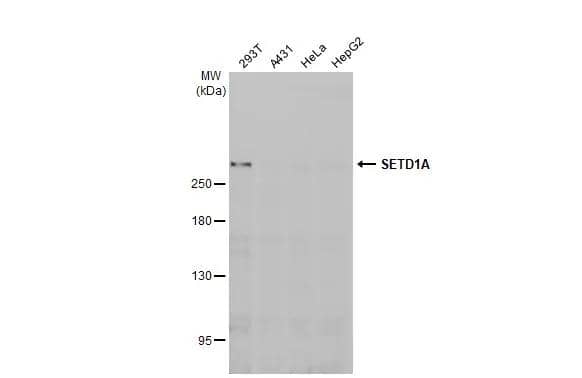 Various whole cell extracts (30 ug) were separated by 5% SDS-PAGE, and the membrane was blotted with SETD1A antibody [HL2707] (NBP3-48723) diluted at 1:1000. The HRP-conjugated anti-rabbit IgG antibody was used to detect the primary antibody. 