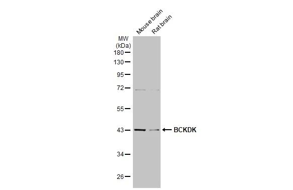 Various tissue extracts (50 ug) were separated by 10% SDS-PAGE, and the membrane was blotted with BCKDK antibody [HL2710] (NBP3-48724) diluted at 1:1000. The HRP-conjugated anti-rabbit IgG antibody was used to detect the primary antibody. 