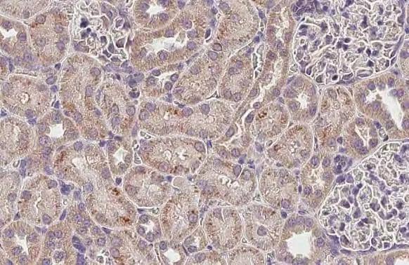 Immunohistochemistry-Paraffin MLYCD Antibody (HL2738)