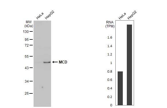 Western Blot MLYCD Antibody (HL2738)