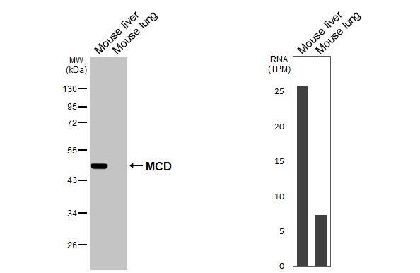 Western Blot MLYCD Antibody (HL2738)