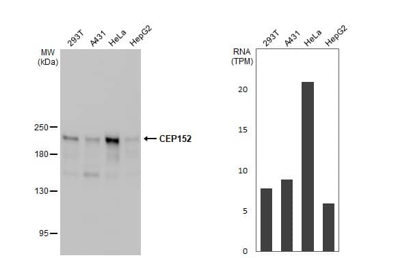 Western Blot CEP152 Antibody (HL2763)