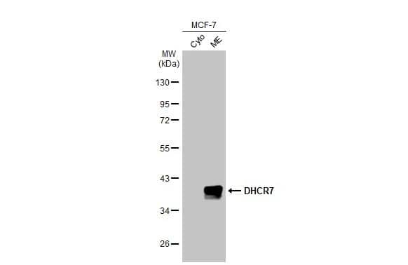 MCF-7 cytosol and membrane extracts (30 ug) were separated by 10% SDS-PAGE, and the membrane was blotted with DHCR7 antibody [HL2764] (NBP3-48728) diluted at 1:1000. The HRP-conjugated anti-rabbit IgG antibody 