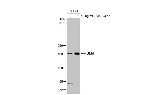 <b>Orthogonal Strategies Validation. </b>Untreated (-) and treated (+) THP-1 whole cell extracts (30 ug) were separated by 5% SDS-PAGE, and the membrane was blotted with Blooms Syndrome Protein Blm antibody [HL2771] (NBP3-48729) diluted at 1:1000. The HRP-conjugated anti-rabbit IgG antibody was used to detect the primary antibody. 