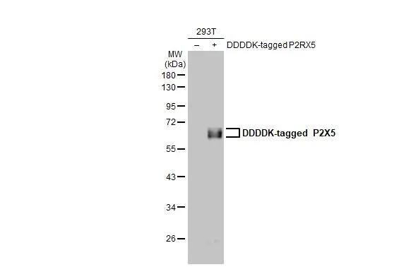 Non-transfected (-) and transfected (+) 293T whole cell extracts (30 ug) were separated by 10% SDS-PAGE, and the membrane was blotted with P2X5/P2RX5 antibody [HL2773] (NBP3-48730) diluted at 1:5000. The HRP-conjugated anti-rabbit IgG antibody was used to detect the primary antibody. 