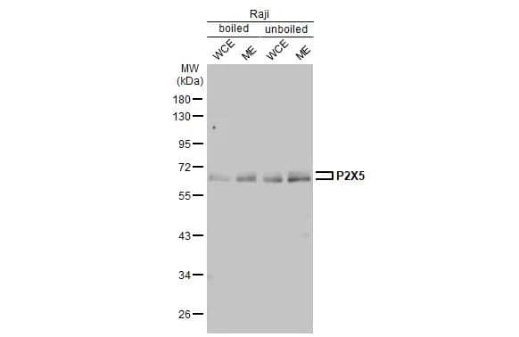 <b>Orthogonal Strategies Validation. </b>Boiled and unboiled Raji whole cell extracts and membrane extracts (30 ug) were separated by 10% SDS-PAGE, and the membrane was blotted with P2X5/P2RX5 antibody [HL2773] (NBP3-48730) diluted at 1:1000. The HRP-conjugated anti-rabbit IgG antibody 