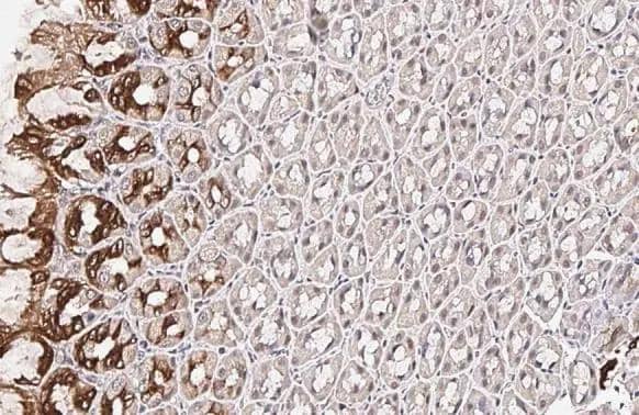 Immunohistochemistry-Paraffin SCAP Antibody (HL2796)
