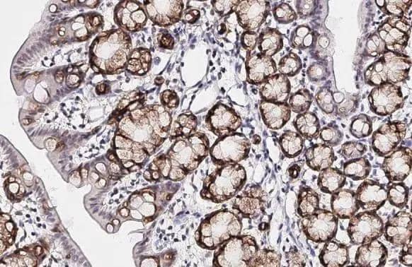 Immunohistochemistry-Paraffin SCAP Antibody (HL2796)