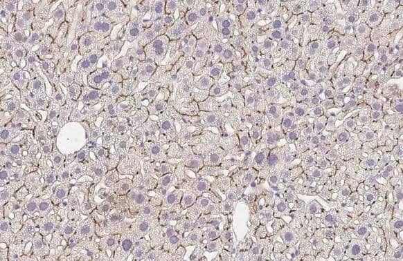 ABCB11 antibody [HL2803] detects ABCB11 protein by immunohistochemical analysis.Sample: Paraffin-embedded mouse liver.ABCB11 stained by ABCB11 antibody [HL2803] (NBP3-48735) diluted at 1:100.Antigen Retrieval: Citrate buffer, pH 6.0, 15 min 