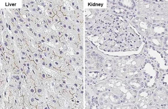 ABCB11 antibody [HL2803] detects ABCB11 protein by immunohistochemical analysis.Sample: Paraffin-embedded human tissue.ABCB11 stained by ABCB11 antibody [HL2803] (NBP3-48735) diluted at 1:100.Antigen Retrieval: Citrate buffer, pH 6.0, 15 min 