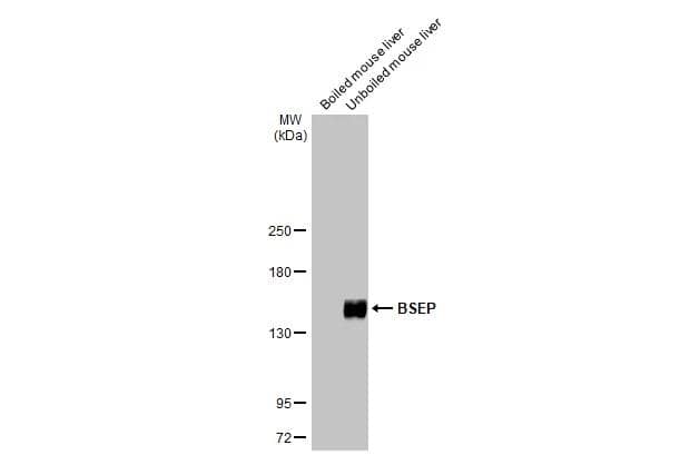 <b>Orthogonal Strategies Validation. </b>Boiled and unboiled mouse liver extracts (50 ug) were separated by 5% SDS-PAGE, and the membrane was blotted with ABCB11 antibody [HL2803] (NBP3-48735) diluted at 1:1000. The HRP-conjugated anti-rabbit IgG antibody was used to detect the primary antibody. 
