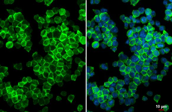 P2Y12/P2RY12 antibody [HL2829] detects P2Y12/P2RY12 protein at cell membrane by immunofluorescent analysis.Sample: THP-1 cells were fixed in 4% paraformaldehyde at RT for 15 min.Green: P2Y12/P2RY12 stained by P2Y12/P2RY12 antibody [HL2829] (NBP3-48736) diluted at 1:500.Blue: Fluoroshield with DAPI . 
