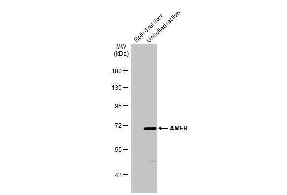 Boiled and unboiled rat tissue extract (50 ug) were separated by 7.5% SDS-PAGE, and the membrane was blotted with AMFR/gp78 antibody [HL2865] (NBP3-48740) diluted at 1:1000. The HRP-conjugated anti-rabbit IgG antibody was used to detect the primary antibody. 
