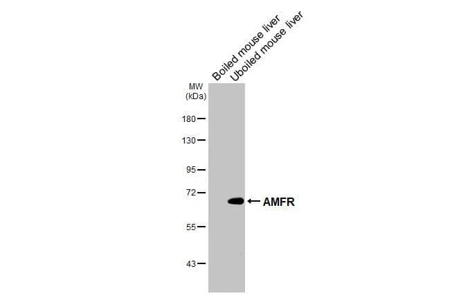<b>Orthogonal Strategies Validation. </b>Boiled and unboiled mouse tissue extract (50 ug) were separated by 7.5% SDS-PAGE, and the membrane was blotted with AMFR/gp78 antibody [HL2866] (NBP3-48741) diluted at 1:1000. The HRP-conjugated anti-rabbit IgG antibody was used to detect the primary antibody. 