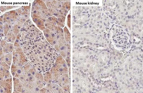 <b>Orthogonal Strategies Validation. </b>Elastase 3A + Elastase 3B antibody [HL2882] detects Elastase 3A + Elastase 3B protein by immunohistochemical analysis.Sample: Paraffin-embedded mouse pancreas tissue (high expression) and kidney tissue (low expression).Elastase 3A + Elastase 3B stained by Elastase 3A + Elastase 3B antibody [HL2882] (NBP3-48742) diluted at 1:100.Antigen Retrieval: Citrate buffer, pH 6.0, 15 min 