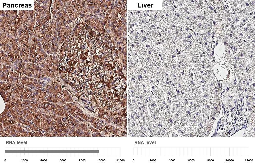 Elastase 3A + Elastase 3B antibody [HL2882] detects Elastase 3A + Elastase 3B protein by immunohistochemical analysis.Sample: Paraffin-embedded human tissues.Elastase 3A + Elastase 3B stained by Elastase 3A + Elastase 3B antibody [HL2882] (NBP3-48742) diluted at 1:200.Antigen Retrieval: Citrate buffer, pH 6.0, 15 min 