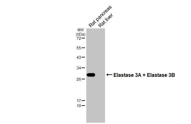 Various tissue extracts (50 �g) were separated by 12% SDS-PAGE, and the membrane was blotted with Elastase 3A + Elastase 3B antibody [HL2882] (NBP3-48742) diluted at 1:1000. The HRP-conjugated anti-rabbit IgG antibody was used to detect the primary antibody. 