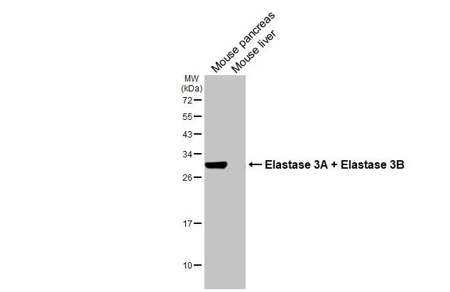 Various tissue extracts (50 �g) were separated by 12% SDS-PAGE, and the membrane was blotted with Elastase 3A + Elastase 3B antibody [HL2882] (NBP3-48742) diluted at 1:1000. The HRP-conjugated anti-rabbit IgG antibody was used to detect the primary antibody. 