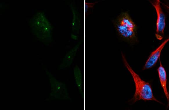 Immunocytochemistry/ Immunofluorescence CEP152 Antibody (HL2884)