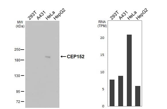 Western Blot CEP152 Antibody (HL2884)