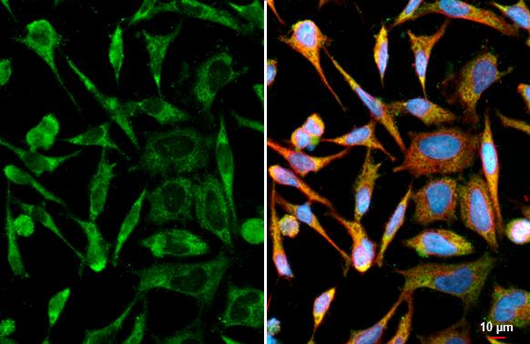 Ataxin-2 antibody [HL2885] detects Ataxin-2 protein at cytoplasm by immunofluorescent analysis.Sample: HeLa cells were fixed in ice-cold MeOH for 5 min.Green: Ataxin-2 stained by Ataxin-2 antibody [HL2885] (NBP3-48744) diluted at 1:500.Red: alpha Tubulin, a cytoskeleton marker, stained by alpha Tubulin antibody [GT114] diluted at 1:1000.Blue: Fluoroshield with DAPI . 