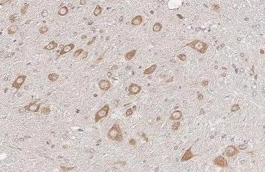 Ataxin-2 antibody [HL2885] detects Ataxin-2 protein by immunohistochemical analysis.Sample: Paraffin-embedded rat brain.Ataxin-2 stained by Ataxin-2 antibody [HL2885] (NBP3-48744) diluted at 1:100.Antigen Retrieval: Citrate buffer, pH 6.0, 15 min 