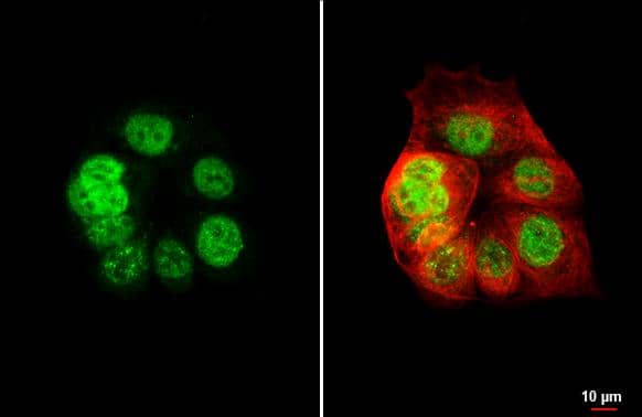 XPC antibody [HL2892] detects XPC protein by immunofluorescent analysis.Sample: MCF-7 cells were fixed in ice-cold MeOH for 5 min.Green: XPC stained by XPC antibody [HL2892] (NBP3-48746) diluted at 1:500.Red: alpha Tubulin, a cytoskeleton marker, stained by alpha Tubulin antibody [GT114] diluted at 1:1000. 