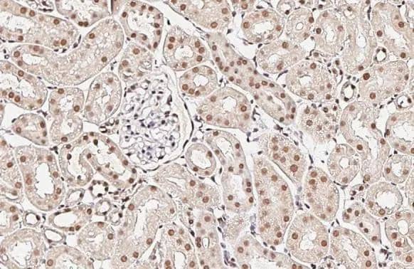 XPC antibody [HL2894] detects XPC protein by immunohistochemical analysis.Sample: Paraffin-embedded mouse kidney.XPC stained by XPC antibody [HL2894] (NBP3-48747) diluted at 1:100.Antigen Retrieval: Citrate buffer, pH 6.0, 15 min 