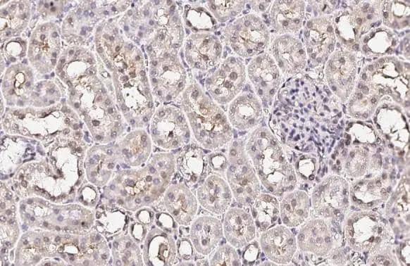 <b>Orthogonal Strategies Validation. </b>XPC antibody [HL2894] detects XPC protein by immunohistochemical analysis.Sample: Paraffin-embedded rat kidney.XPC stained by XPC antibody [HL2894] (NBP3-48747) diluted at 1:100.Antigen Retrieval: Citrate buffer, pH 6.0, 15 min 