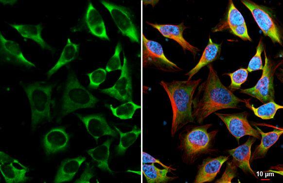 YTHDF2 antibody [HL2910] detects YTHDF2 protein by immunofluorescent analysis.Sample: HeLa cells were fixed in 4% paraformaldehyde at RT for 15 min.Green: YTHDF2 stained by YTHDF2 antibody [HL2910] (NBP3-48749) diluted at 1:500.Red: alpha Tubulin, a cytoskeleton marker, stained by alpha Tubulin antibody [GT114] diluted at 1:1000.Blue: Fluoroshield with DAPI . 