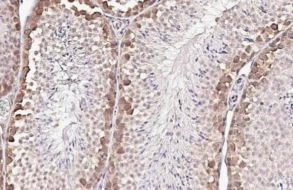 YTHDF2 antibody [HL2910] detects YTHDF2 protein by immunohistochemical analysis.Sample: Paraffin-embedded mouse testis.YTHDF2 stained by YTHDF2 antibody [HL2910] (NBP3-48749) diluted at 1:100.Antigen Retrieval: Citrate buffer, pH 6.0, 15 min 