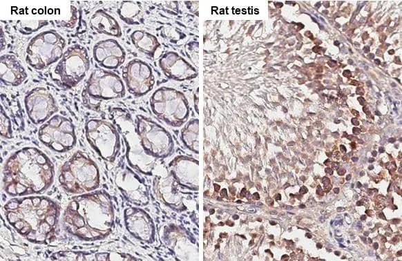 YTHDF2 antibody [HL2910] detects YTHDF2 protein by immunohistochemical analysis.Sample: Paraffin-embedded rat tissues.YTHDF2 stained by YTHDF2 antibody [HL2910] (NBP3-48749) diluted at 1:100.Antigen Retrieval: Citrate buffer, pH 6.0, 15 min 