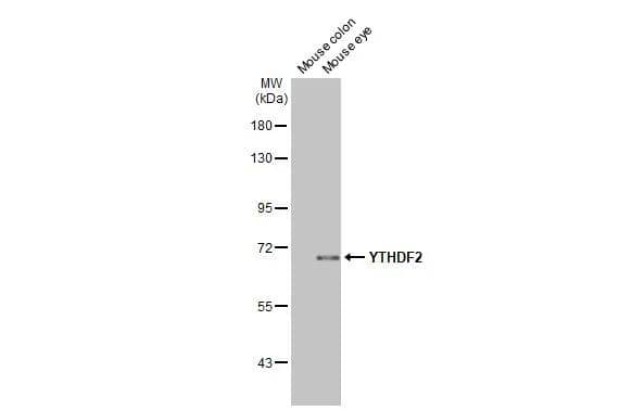 Various tissue extracts (50 ug) were separated by 7.5% SDS-PAGE, and the membrane was blotted with YTHDF2 antibody [HL2910] (NBP3-48749) diluted at 1:1000. The HRP-conjugated anti-rabbit IgG antibody was used to detect the primary antibody. 