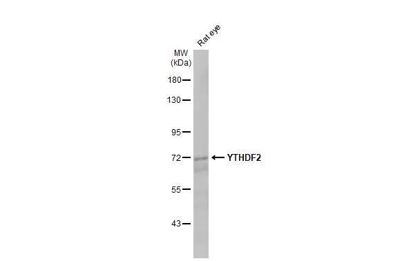 Rat tissue extract (50 ug) was separated by 7.5% SDS-PAGE, and the membrane was blotted with YTHDF2 antibody [HL2910] (NBP3-48749) diluted at 1:1000. The HRP-conjugated anti-rabbit IgG antibody was used to detect the primary antibody, and the signal was developed with Trident ECL plus-Enhanced. 