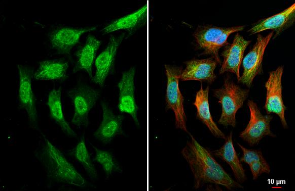 AKT antibody [HL2915] detects AKT protein by immunofluorescent analysis.Sample: HeLa cells were fixed in ice-cold MeOH for 5 min.Green: AKT stained by AKT antibody [HL2915] (NBP3-48751) diluted at 1:500.Red: alpha Tubulin, a cytoskeleton marker, stained by alpha Tubulin antibody [GT114] diluted at 1:1000.Blue: Fluoroshield with DAPI . 